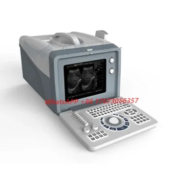 Design personalizado XF218 Digital Completa Máquina Portátil sem Fio ultra-som Fetal Scanner